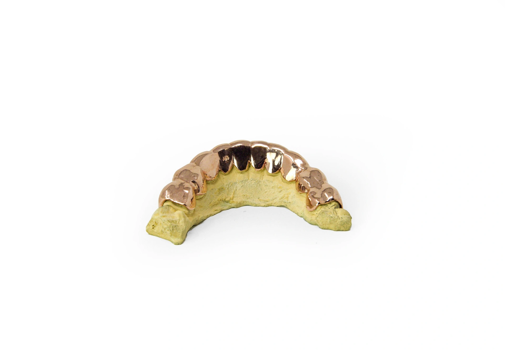 10k Gold Grillz